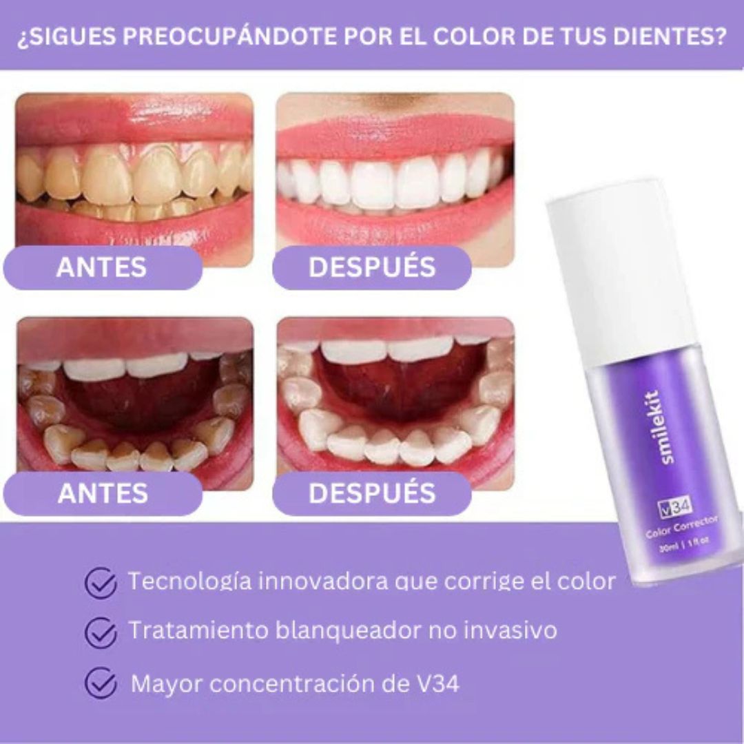 LumiDent Pro™ V34 Blanqueador Dental